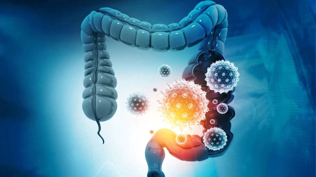 Leaky Gut Syndrome
